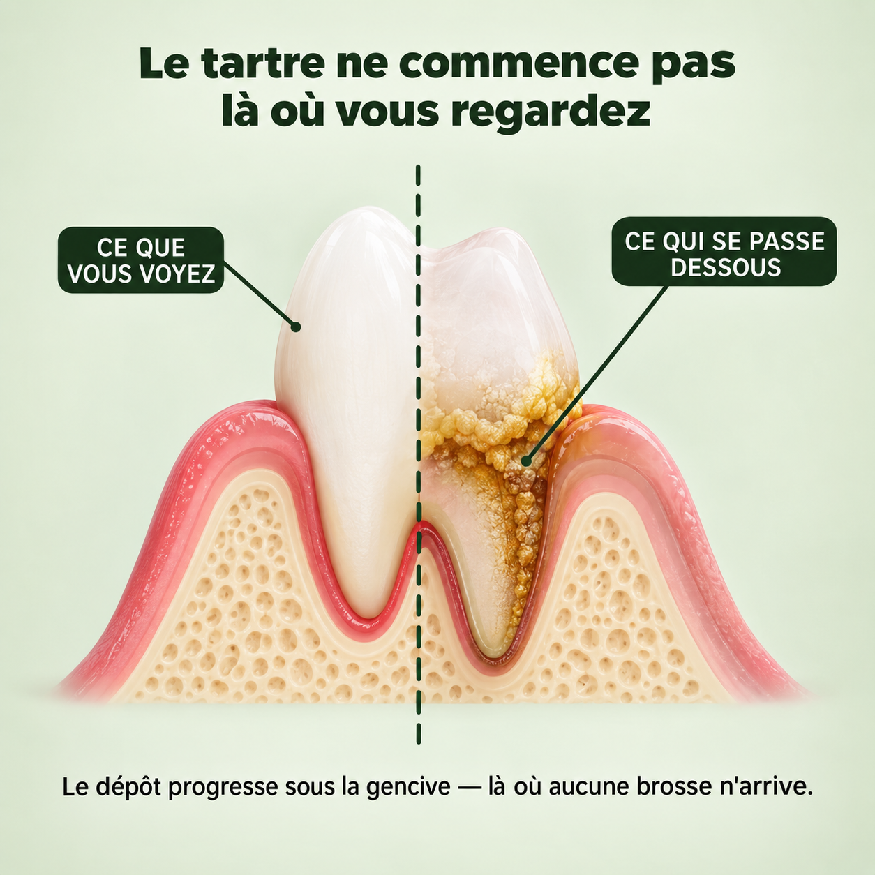 Spray Dentaire PureHaleine